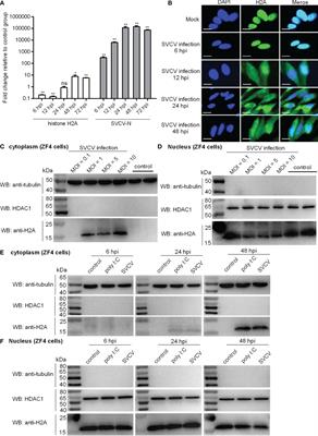 Histone H2A Nuclear/Cytoplasmic Trafficking Is Essential for Negative Regulation of Antiviral Immune Response and Lysosomal Degradation of TBK1 and IRF3